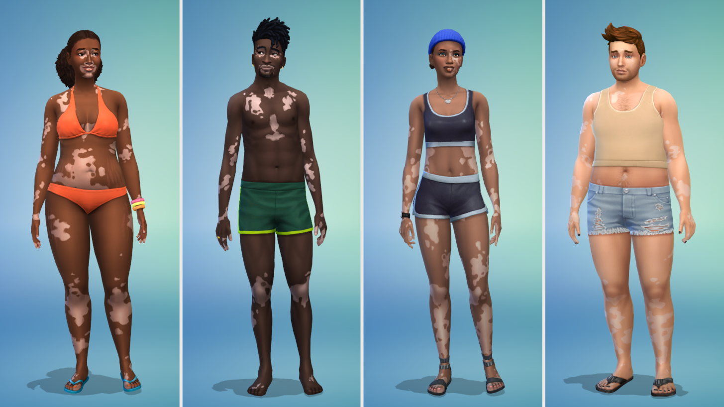 The Sims 4 Menghadirkan Opsi Vitiligo di Game